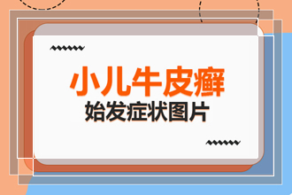 对于牛皮癣儿童的心理健康方面我们家长需要多关注吗